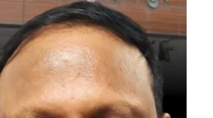 भ्रष्टाचार का आरोप लगाने वाले सिविल सर्जन को खुद करना होगा अदालत का सामना